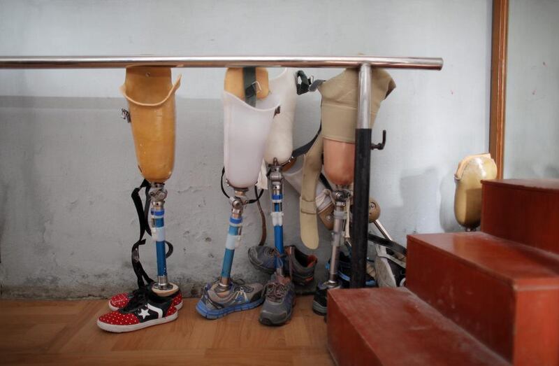 Prosthetics at an orthopaedic rehabilitation centre in Kathmandu. Dan Maya Maharjan is among those who has received a prosthetic limb as she rebuilds her life after the earthquake. Last Thursday was International Day of Persons with Disabilities. Niranjan Shrestha / AP Photo