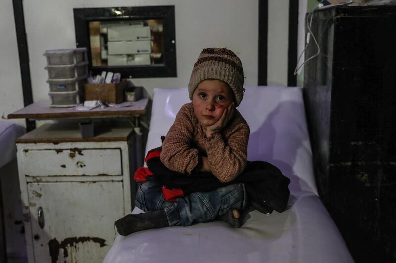 Yousef, 6 years old, injured in a shelling sits in a hospital in Douma, Eastern Ghouta on March 3, 2018. Mohammed Badra / EPA