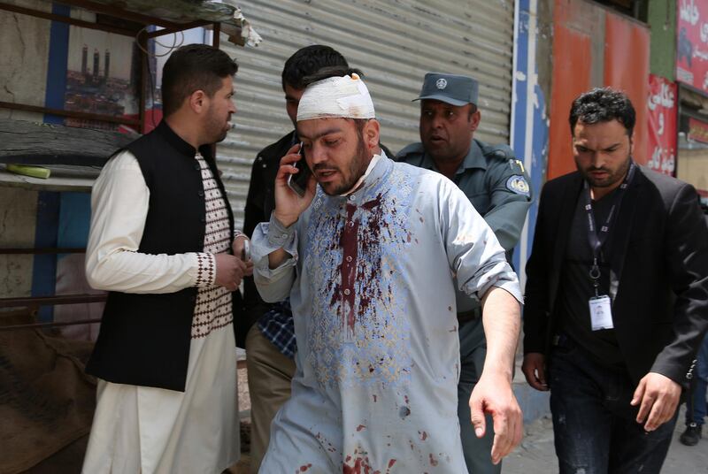 An injured man talks on his mobile phone after an explosion in Kabul, Afghanistan. AP Photo