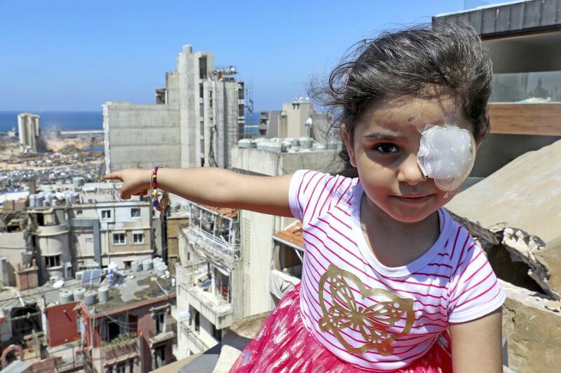 Sama al-Hamad, 6-year-old Syrian girl who lost her left eye in the August 4 cataclysmic explosion, points at the blast site from the roof of her damaged house in Beirut's Mar Mikhael district on August 16, 2020. - The powerful August 4 explosion that killed 177 people and devastated swathes of the Lebanese capital also left thousands wounded, mostly from flying shards of glass. At least 400 people suffered ocular injuries, more than 50 required surgery, and at least 15 were permanently blinded in one eye, according to data compiled by major hospitals in and around Beirut. (Photo by ANWAR AMRO / AFP)