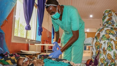 A nurse attends to a patient who is suffering from severe malnutrition in Bay Regional Hospital in Baidoa, Somalia, in June 2022. AP