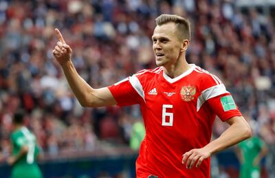 epa06807802 Denis Cheryshev of Russia celebrates after scoring the 4-0 during the FIFA World Cup 2018 group A preliminary round soccer match between Russia and Saudi Arabia in Moscow, Russia, 14 June 2018.

(RESTRICTIONS APPLY: Editorial Use Only, not used in association with any commercial entity - Images must not be used in any form of alert service or push service of any kind including via mobile alert services, downloads to mobile devices or MMS messaging - Images must appear as still images and must not emulate match action video footage - No alteration is made to, and no text or image is superimposed over, any published image which: (a) intentionally obscures or removes a sponsor identification image; or (b) adds or overlays the commercial identification of any third party which is not officially associated with the FIFA World Cup) Artem Dzyuba of Russia celebrates after scoring the 3-0 during to the FIFA World Cup 2018 group A preliminary round soccer match between Russia and Saudi Arabia in Moscow, Russia, 14 June 2018.

(RESTRICTIONS APPLY: Editorial Use Only, not used in association with any commercial entity - Images must not be used in any form of alert service or push service of any kind including via mobile alert services, downloads to mobile devices or MMS messaging - Images must appear as still images and must not emulate match action video footage - No alteration is made to, and no text or image is superimposed over, any published image which: (a) intentionally obscures or removes a sponsor identification image; or (b) adds or overlays the commercial identification of any third party which is not officially associated with the FIFA World Cup)  EPA/FELIPE TRUEBA   EDITORIAL USE ONLY EDITORIAL USE ONLY