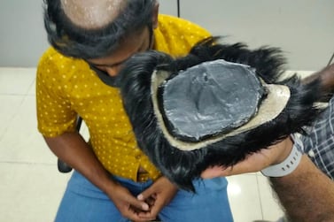 Chennai Customs officials arrested six men for attempting to smuggle 5.5 kilograms of gold underneath their wigs. Courtesy Chennai Customs