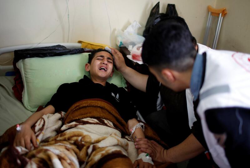 A young Palestinian who was wounded at the Israel-Gaza border reacts at al-Shifa hospital in Gaza City April 1, 2018. REUTERS/Mohammed Salem