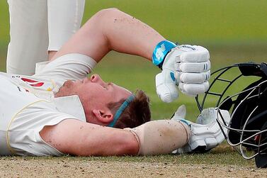 Australia's Steve Smith lays on the pitch after being hit in the head by a ball off the bowling of England's Jofra Archer during play on the fourth day of the second Ashes Test at Lord's. AFP