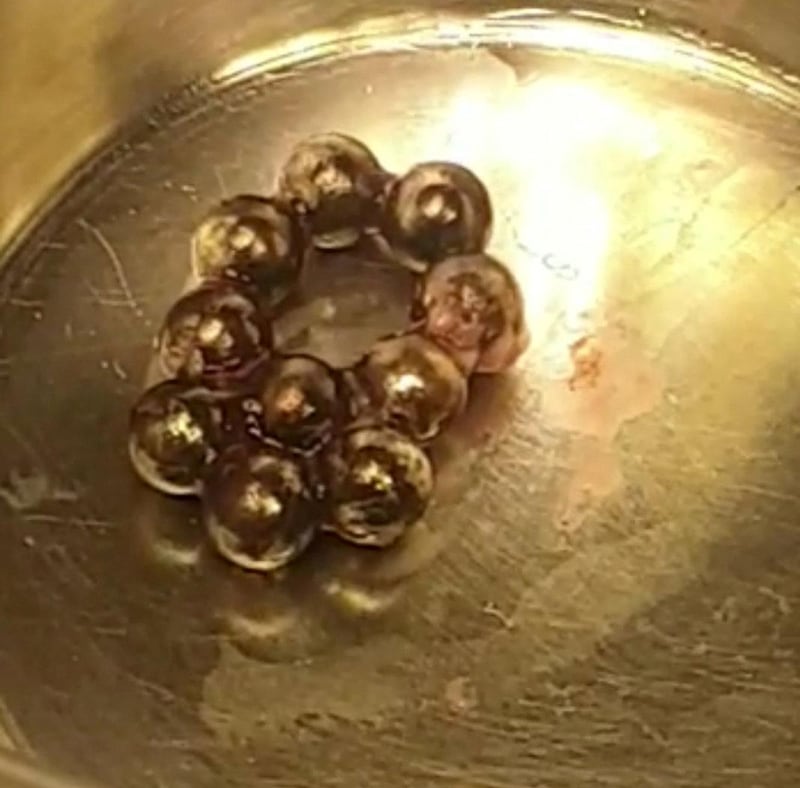 High-powered magnetic beads recovered from baby Althea's intestines. Courtesy Medeor Hospital 