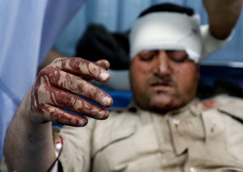 ATTENTION EDITORS - VISUAL COVERAGE OF SCENES OF INJURY OR DEATH   An Afghan injured man receives treatment at a hospital after a car bomb blast in Kabul, Afghanistan January 14, 2019. REUTERS/Omar Sobhani   TEMPLATE OUT