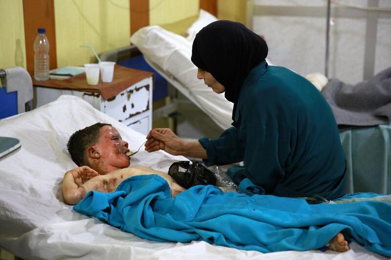 A severely burned young boy is fed as he lies in the intensive care unit of a hospital in the rebel-held area of Douma, east of the capital Damascus, following reported mortar shelling by Syrian government forces on August 28, 2015. Abd Doumany/AFP Photo

