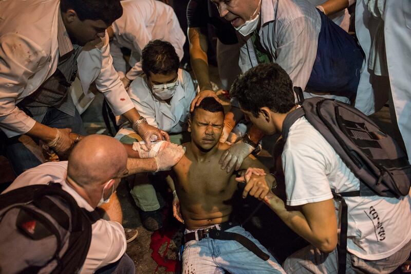 An injured demonstrator is helped by fellow protesters and treated by a doctor,  left, who said the man was shot in the shoulder,  during a protest in Rio de Janeiro, Brazil, Monday, June 17, 2013. Officers in Rio fired tear gas and rubber bullets when a group of protesters invaded the state legislative assembly and threw rocks and flares at police. Protesters massed in at least seven Brazilian cities Monday for another round of demonstrations voicing disgruntlement about life in the country, raising questions about security during big events like the current Confederations Cup and a papal visit next month.  It was not clear who shot the man. (AP Photo/Felipe Dana) *** Local Caption ***  Brazil Confed Cup Protest.JPEG-04111.jpg