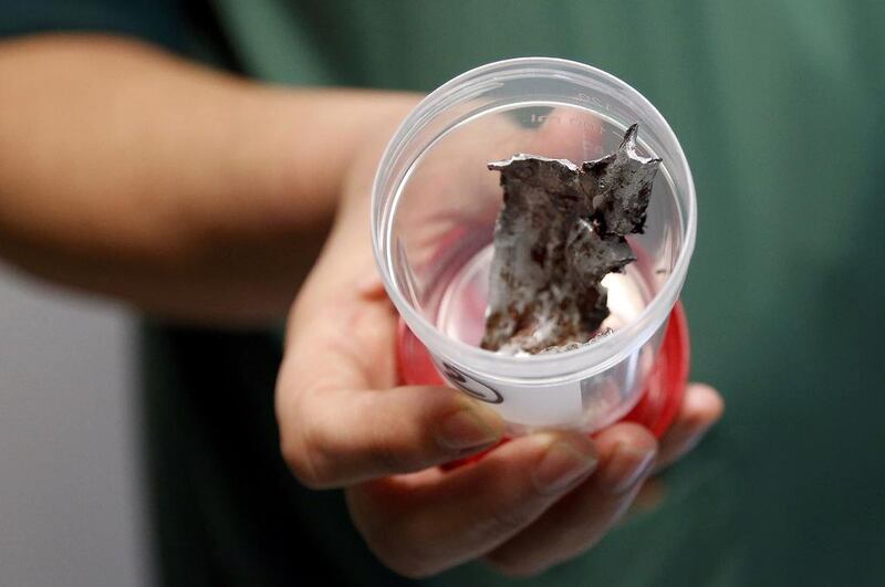 A surgeon at the Gasthuisberg hospital in Louvain, Belgium, shows shrapnel removed from victims of Tuesday’s bombing attacks in Brussels following Tuesday’s airport bombings in Brussels, Belgium. Francois Lenoir / Reuters