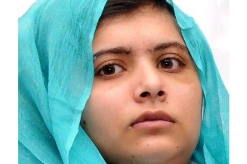 Malala Yousufzai deserves support, a reader says. AFP / Queen Elizabeth Hospital/University Hospitals Birmingham
