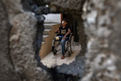 Palestinian teenager Wahid Al Ghalban, 13, lost an eye, arm and leg in an Israeli air strike in Gaza. EPA