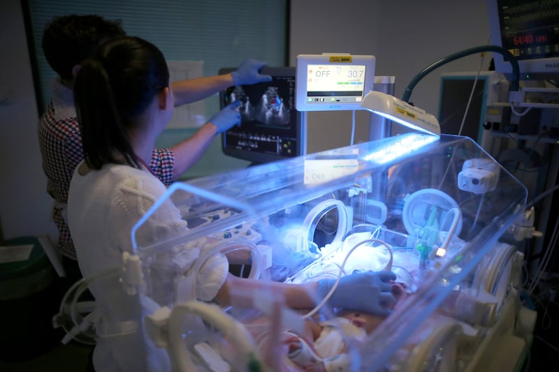 Doctors treat a baby, receiving light therapy, inside an incubator in the Birmingham Women's Hospital in 2015. Getty Images