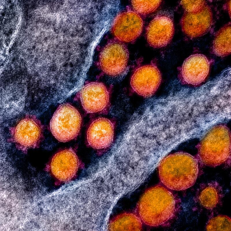 A National Institutes of Health transmission electron micrograph of the coronavirus.