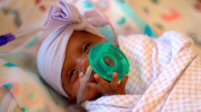 This March, 2019 photo provided by Sharp HealthCare in San Diego shows a baby named Saybie. Sharp Mary Birch Hospital for Women & Newborns said in a statement Wednesday, May 29, 2019, that Saybie, born at 23 weeks and three days, is believed to be the world's tiniest surviving baby, who weighed just 245 grams (about 8.6 ounces) before she was discharged as a healthy infant. She was sent home this month weighing 5 pounds (2 kilograms) after nearly five months in the hospital's neonatal intensive care unit. (Sharp HealthCare via AP)