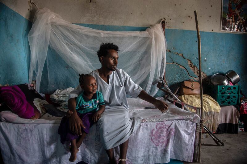 Khalifa Ibrahim, 33, lives in the camp with his family after fleeing Eritrea and then Hitsats camp in Tigray. ‘On November 22, 2020, the war broke out between the TPLF and the Eritrean forces on the camp. I saw eight people die and 12 were injured, including me,' he says. Getty