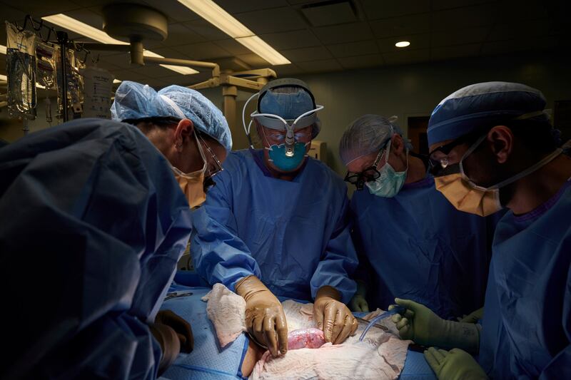 A surgical team at NYU Langone Health in New York City examines a pig kidney attached to the body of a deceased recipient for any signs of rejection. NYU Langone Health via AP