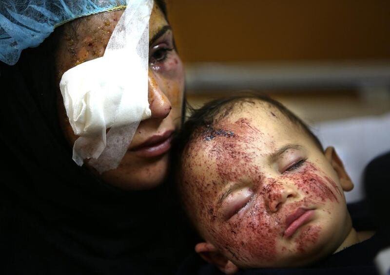 A Lebanese woman, Ghadeer Mortada, 18, who was wounded along with three members of her family, holds her one-year-old boy, Mohammed, in a hospital on Sunday, February 2, 2014., after a deadly car bomb exploded on Saturday evening, in the predominately Shiite town of Hermel, about 16 kilometres from the Syrian border in northeast Lebanon. Hussein Malla/AP Photo