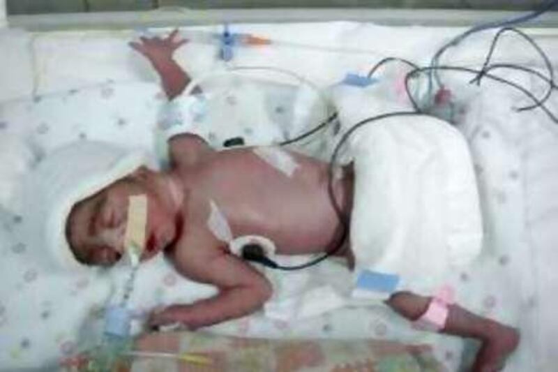 DUBAI-NOVEMBER 21,2008- One of four quadruplets born to a Sudanese woman at Al Wasl Hospital's ICU. Photo Courtesy Al Wasl Hospital *** Local Caption ***   PV Quadruplets1.JPG PV Quadruplets1.JPG