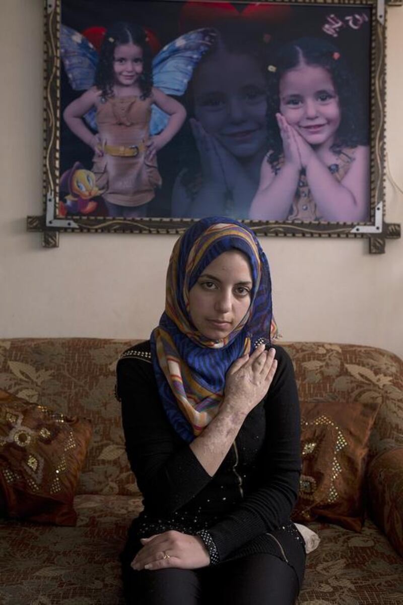 Rawya abu Jom’a nearly one year after last summer’s war , sits under a picture frame showing photographs of her 4 year-old sister Rehav who was killed together with her two aunts when their apartment in Gaza City was hit by an Israeli airstrike. Although the horrific shrapnel wounds have healed on her face , the memories of the war give her flash backs and nightmares still one year later .She is unable to use her right hand because the nerves and bones were badly damaged . She spent 4 months being treated in Jordan following the war but still needs further surgery . She was supposed to start her first year of university but could not because she can not write. Heidi Levine for The National