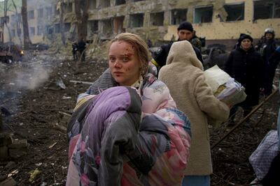 Mariana Vishegirskaya gave birth to a girl a day after she was injured in the Russian bombing of a Mariupol maternity hospital. AP