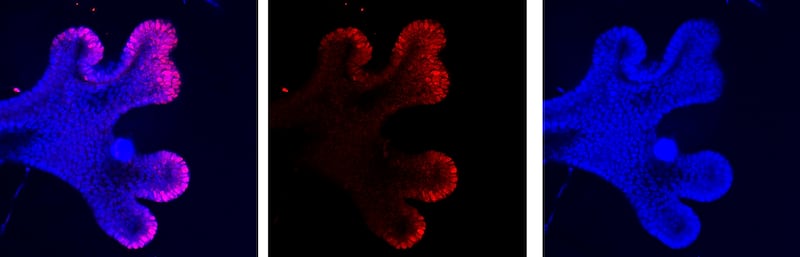 By introducing ‘pillars’ of a polymer next to a growing micro-lung, the cells can be encouraged to branch. Photo: Zayed Centre for Research