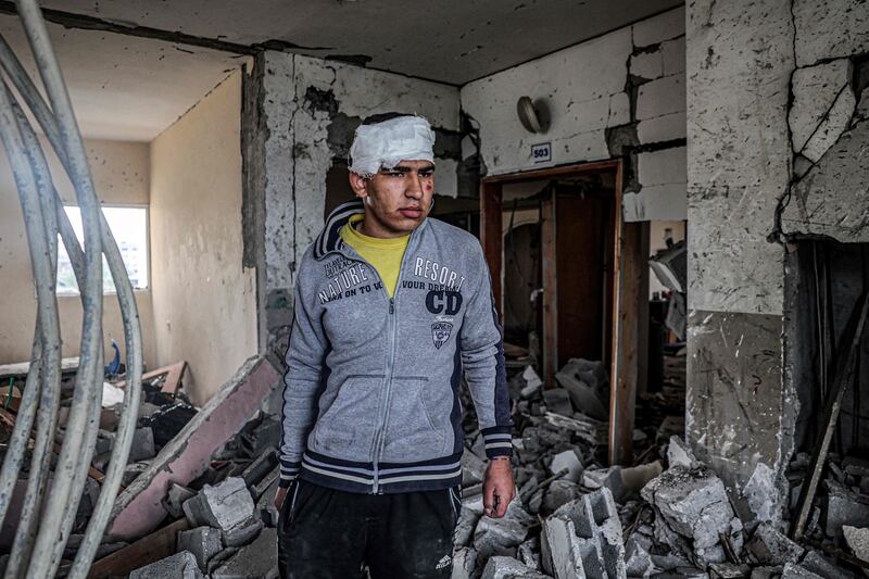 An injured boy inside a building damaged by overnight Israeli strikes on Rafah. AFP