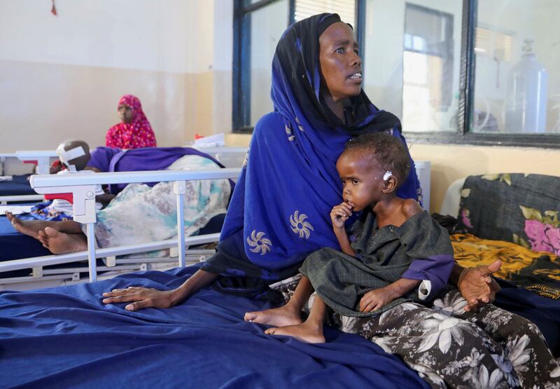 Hajira Ali holds her malnourished child, Farhia Hassan, 2.