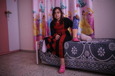 Palestinian girl, Farah Sleem, 11-year-old, holds a prosthetic limb that she wears in her right leg. She was amputated as a result of an Israeli bombing of her family's home in Gaza City during the Israeli round of escalation on the Gaza Strip in May 2021. Majd Mohamad for The National