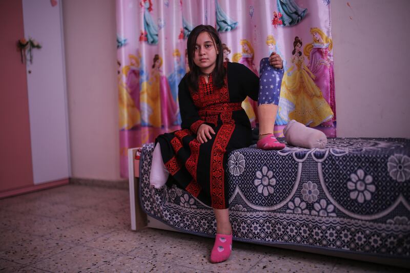 Palestinian girl Farah Sleem, 11, holds her prosthetic limb. Her leg was amputated as a result of the Israeli bombing of her family's home in Gaza city in May. Majd Mohamad for The National