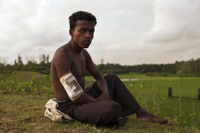 Ahammed Ullah is 20 years old from Saitaburuikka, Maungdaw he was shot in the arm when the Burmese military attacked his village. More than 270,000 Rohingya refugees have fled across the border from Rakhine State, Myanmar, into Bangladesh since 25 August. As many as 80 per cent of them are women and children. Many more children in need of support and protection remain in the areas of northern Rakhine State that have been wracked by violence.