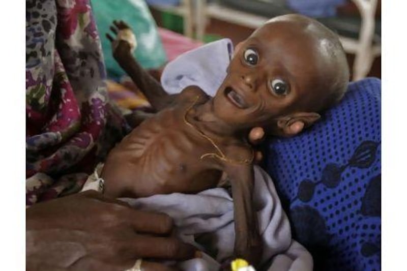 Minhaj Gedi Farah was severely malnourished when he arrived at the Dadaab refugee camp in Kenya late last month.