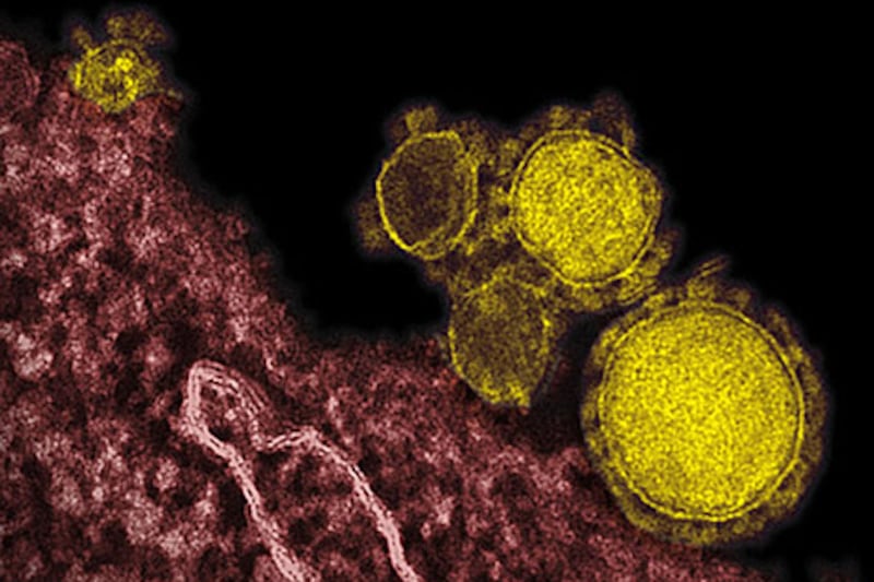 A man from Al Ain has tested positive for the Mers virus, the World Health Organisation confirmed on Monday. AP