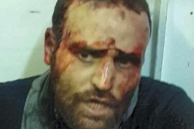 Hisham Ashmawi after his capture in the former ISIS stronghold of Derna, Libya