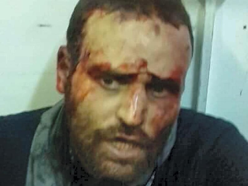 Hisham Ashmawi after his capture in the former ISIS stronghold of Derna, Libya