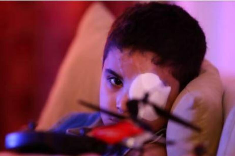 Yousef ben Lafi, seen here playing with his toy airplane while recovering at his home in Ajman, was blinded in his left eye when hand sanitiser spurted out into his left eye. He wants to become a pilot. Pawan Singh / The National