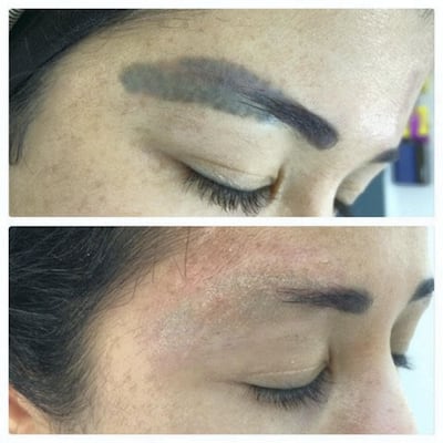 Patsy Kerr, founder of Brows by Patsy, shares an image of a client who came in with an unsatisfactory shape, poor symmetry and bad colouring following a botched eyebrow job 