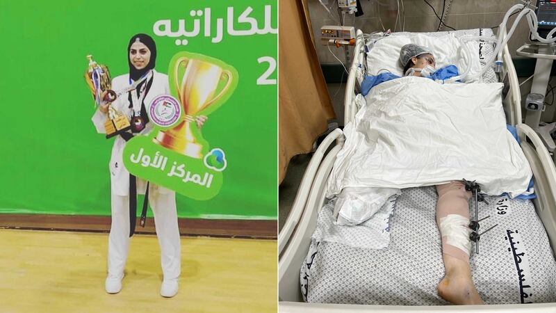 Palestinian karate champion Nagham Abu Samra before and after Israeli air strikes caused her to lose a leg. She was treated in Al Aqsa Martyrs' hospital in Deir Al Balah. Photo: Mohammad Abu Samra