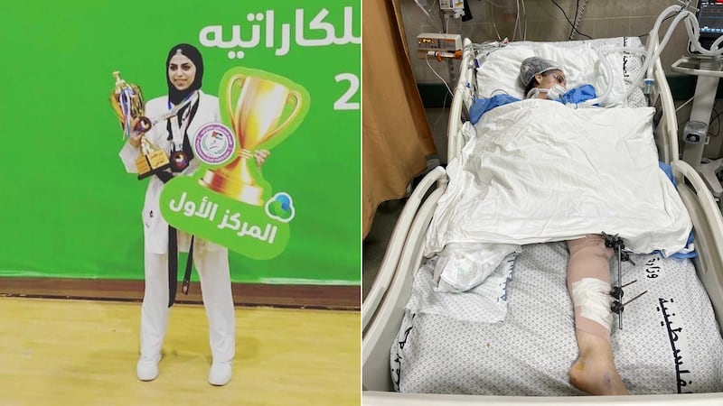 Nagham Abu Samra, a karate champion from Gaza, had her leg amputated after an Israeli strike and remained in a coma until her death in an Egyptian hospital. Photo: Mohammad Abu Samra