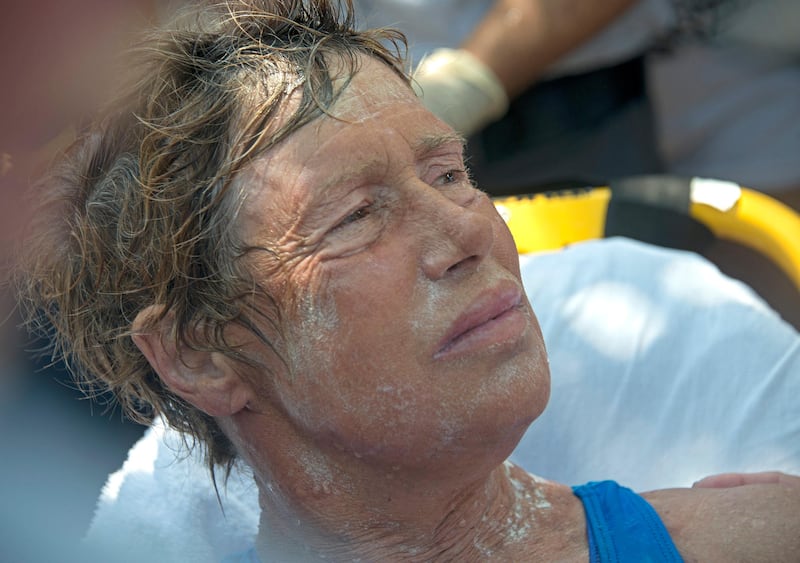 Diana Nyad receives medical treatment after completing a 111-mile swim from Cuba to Key West, Florida, on September 2, 2013.  Nyad, 64, is the first swimmer to cross the Florida Straits without the security of a shark cage. The swim took Nyad 52 hours and 54 minutes, according to a support team member.   AFP PHOTO / Florida Keys News Bureau / Andy NEWMAN    == RESTRICTED TO EDITORIAL  USE / MANDATORY CREDIT:  "AFP PHOTO /  FLORIDA KEYS NEWS BUREAU / Andy NEWMAN"/  NO SALES / NO MARKETING / NO ADVERTISING CAMPAIGNS / DISTRIBUTED AS A SERVICE TO CLIENTS ==
 *** Local Caption ***  857776-01-08.jpg