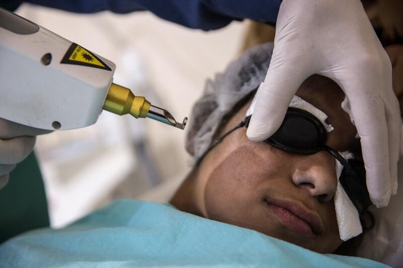 Dr. Salah Al Zanin ,Gaza's plastic surgeon as he uses laser treatment to remove a large birth mark on the face of Faten ,15, who is accompanied by her mother at his clinic in Gaza City on November 3,2018. (Photo by Heidi Levine for The National).