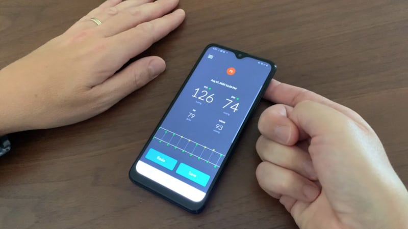 Tech firm Biospectal developed the OptiBP app that allows blood pressure to be monitored effectively using a smartphone’s camera. Photo: Biospectal