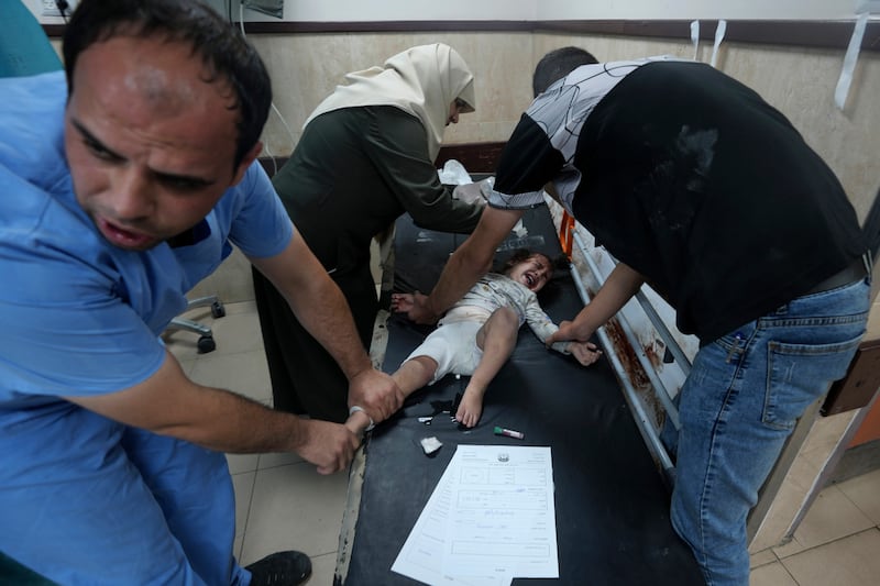 A Palestinian child is treated in Al Aqsa Hospital in Deir al Balah. AP