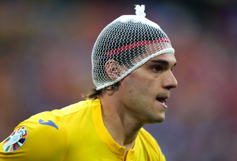 Romania's Ianis Hagi wearing a bandage after he took a knock to the head. PA 