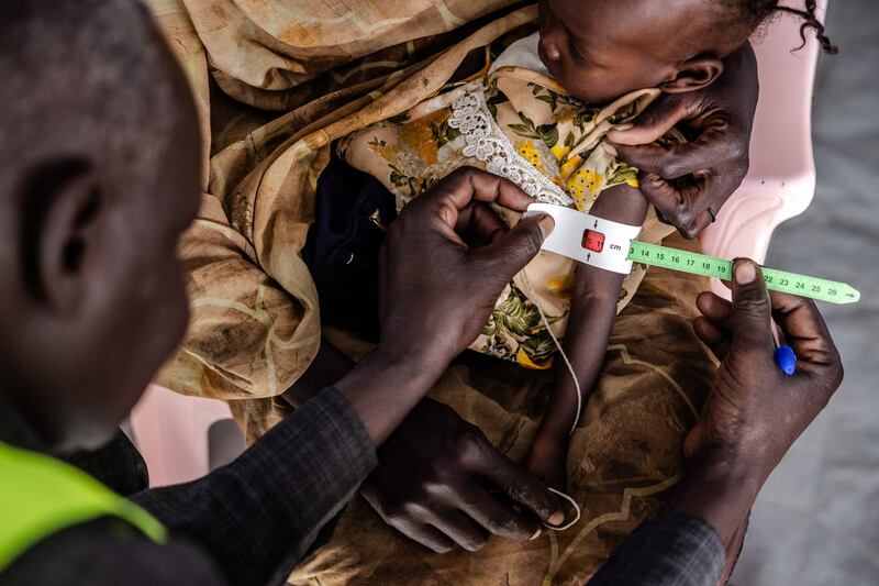 A health worker measures the circumference of a Sudanese child's arm at a clinic within a transit centre for refugees in Renk