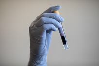 Blood test can detect cancer seven years before it develops