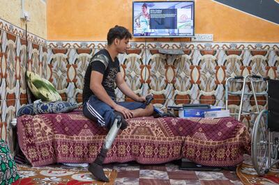 Jasim Abdulameer, 22, a former Iraqi Hashd Al Shaabi fighter, got injured during a military operation against the Islamic State. Amputee and jobless, Abdulameer lives now at his parent's house, in Basra, a major city in south Iraq. Photo by Sebastian Castelier