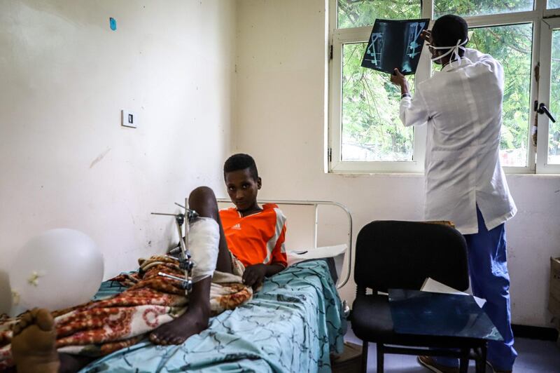 A boy who was shot allegedly by security forces during the violence that erupted in the town of Kokosa. AFP