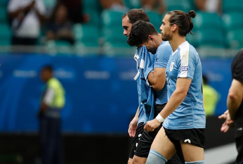 Luis Suarez is consoled by teammates after Uruguay's Copa America quarter-final defeat. AP Photo