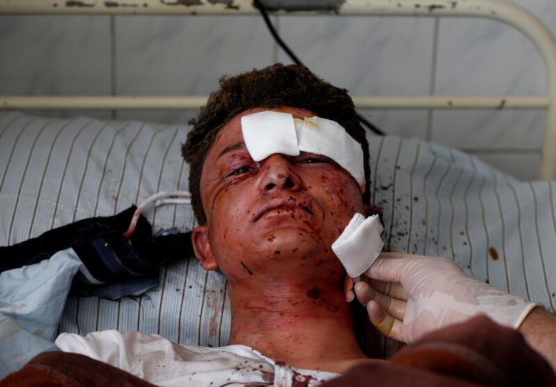 ATTENTION EDITORS - VISUAL COVERAGE OF SCENES OF INJURY OR DEATH An Afghan man receives treatment at a hospital after a suicide attack in Kabul, Afghanistan March 21, 2018. REUTERS/Omar Sobhani     TEMPLATE OUT